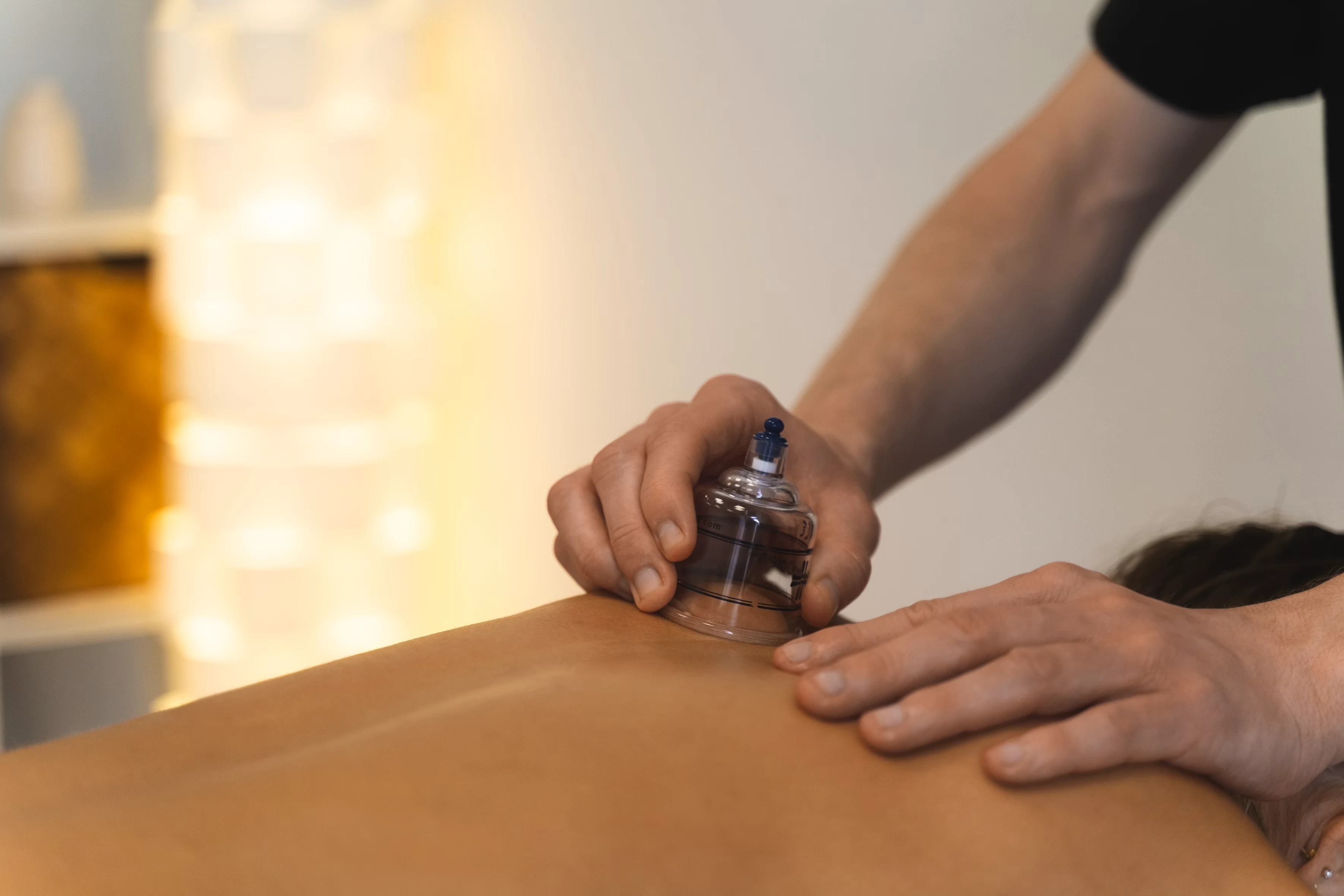 Cupping behandeling bij Van Dooren Sportzorg